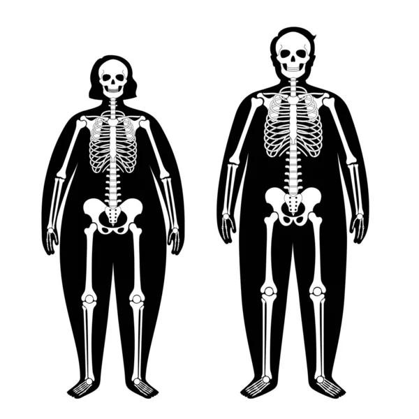 Anatomia do esqueleto obeso —  Vetores de Stock