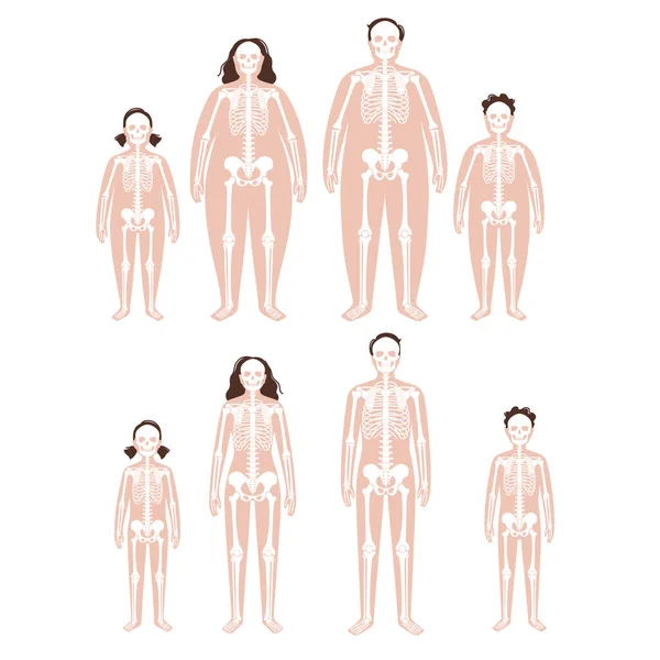 Anatomia dello scheletro obesa — Vettoriale Stock