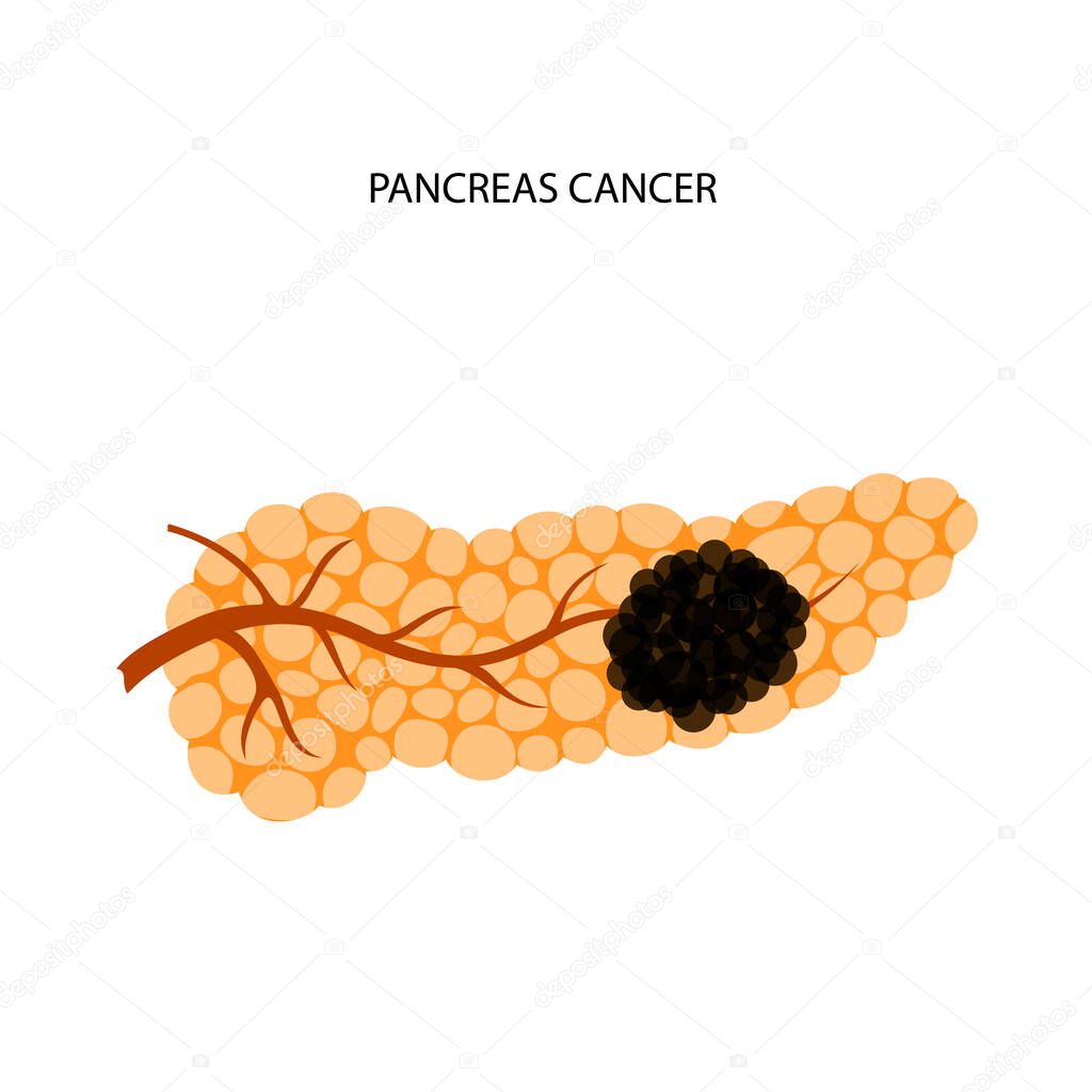 Pancreatic cancer logo, pancreas disease. Medical appointment and treatment in clinic. Tumor, pain and inflammation in digestive system. Human internal organs anatomical exam flat vector illustration.