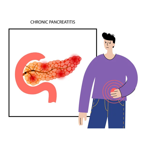 胰腺疾病和癌症 — 图库矢量图片
