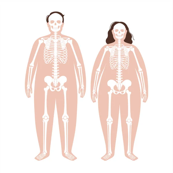 Anatomía del esqueleto obeso — Vector de stock