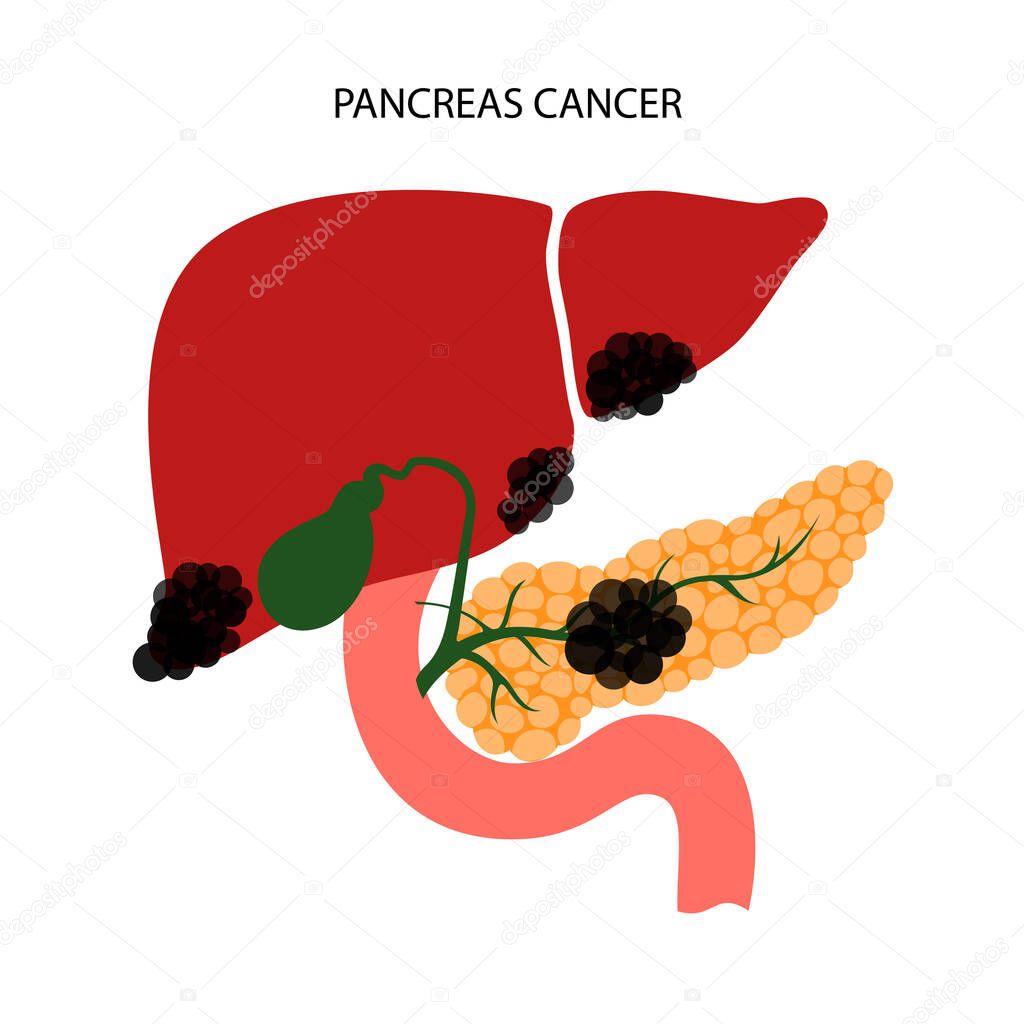 Pancreatic cancer logo, pancreas disease. Medical appointment and treatment in clinic. Tumor, pain and inflammation in digestive system. Human internal organs anatomical exam flat vector illustration.