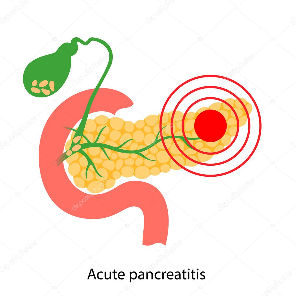 Pancreas disease logo, acute pancreatitis. Medical appointment and treatment in clinic. Pain and inflammation in digestive system. Human internal organs anatomical examination flat vector illustration