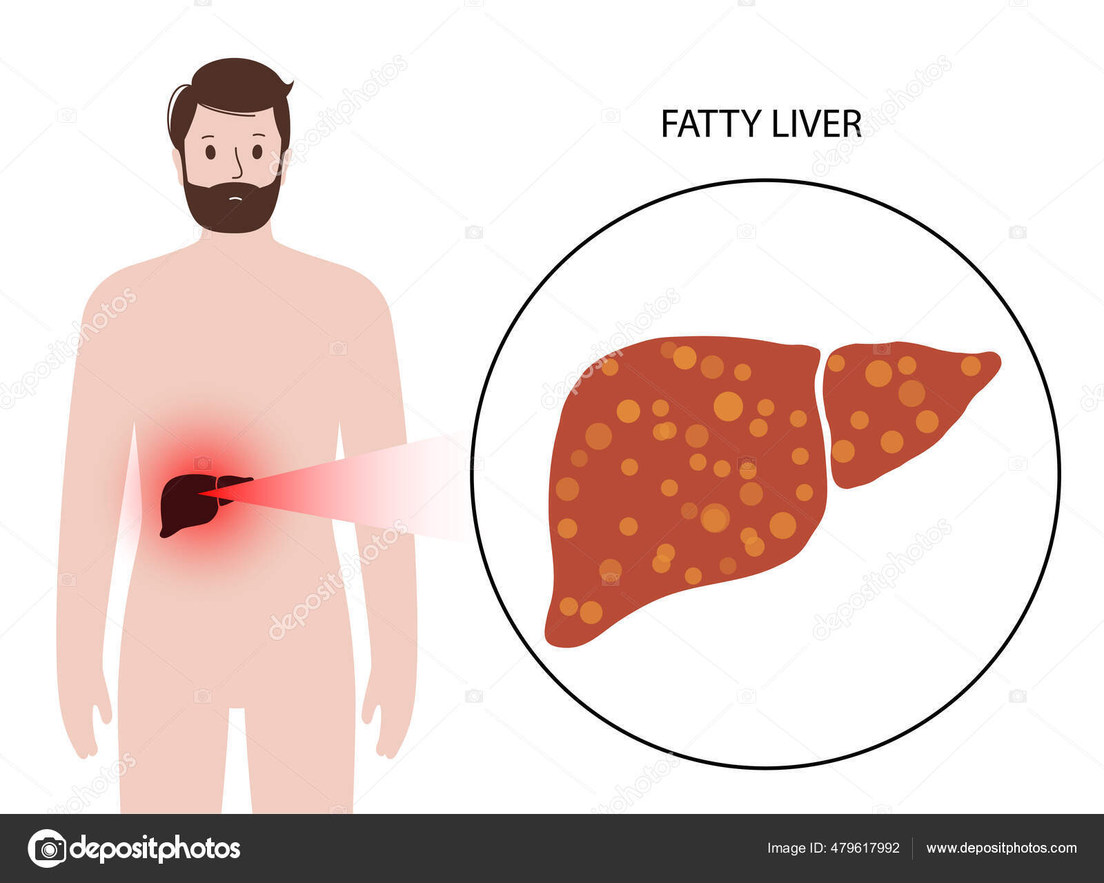 Liver disease concept Stock Vector by ©Pikovit 479617992
