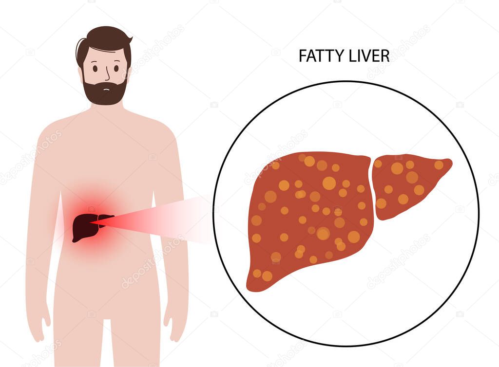 Liver disease concept