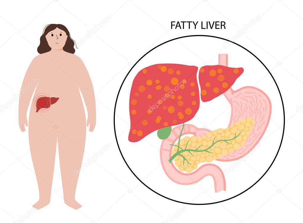 Liver disease concept