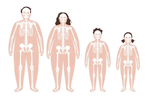 Anatomie des fettleibigen Skeletts — Stockvektor