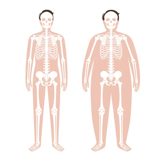 Anatomia do esqueleto obeso —  Vetores de Stock