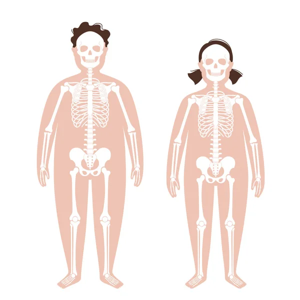 Anatomie du squelette obèse — Image vectorielle