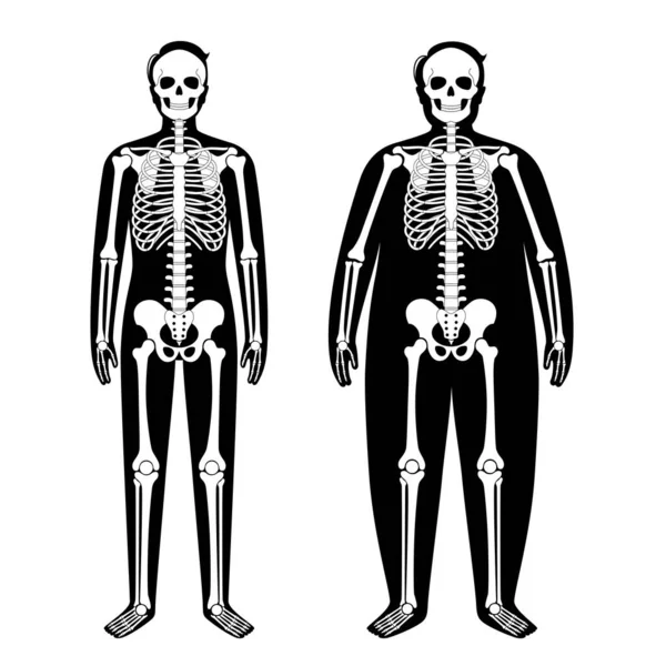 Obese skeleton anatomy — Stock Vector