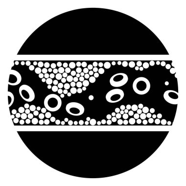 Kolesterol ve ateroskleroz.