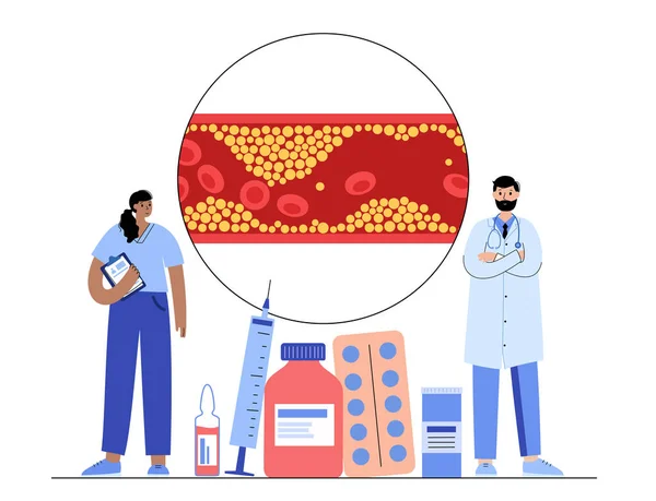 Cholesterol bloedvat — Stockvector