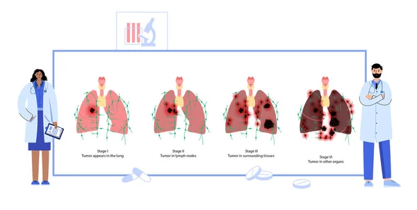 肺がん疾患 — ストックベクタ