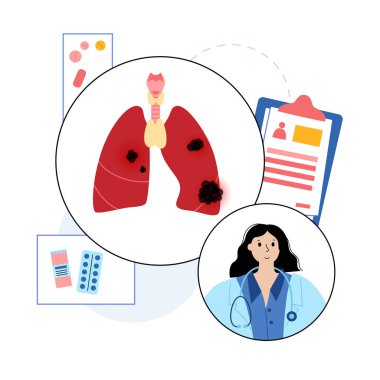 Akciğer kanseri hastalığı