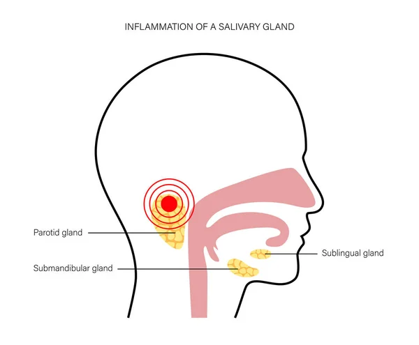 Salivary gland concept — Stock Vector