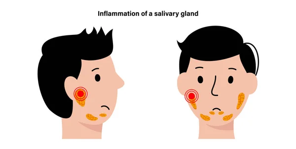 Conceito de glândula salivar —  Vetores de Stock