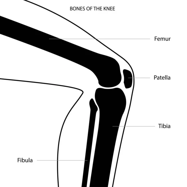 Anatomía del hueso de la rodilla — Archivo Imágenes Vectoriales