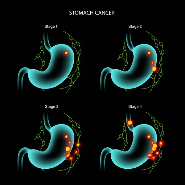 Magcancer anatomi — Stock vektor