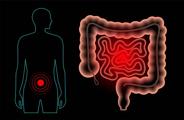 Concetto di dolore intestinale — Vettoriale Stock