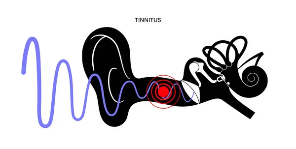 Tinnitus sjukdom koncept — Stock vektor