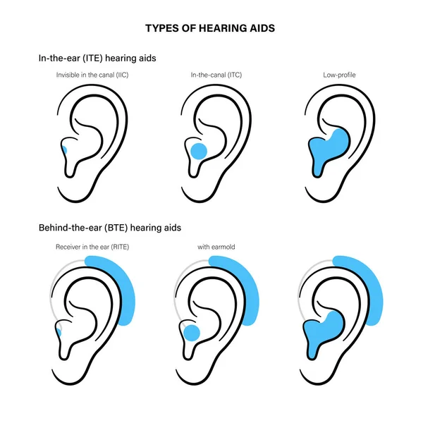 Hearing aids types — Stock Vector