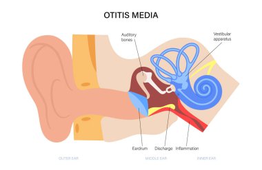 otitis medya hastalığı