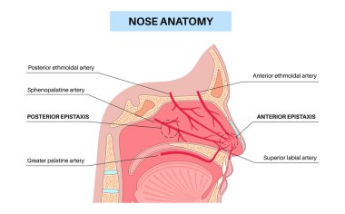 Burnu kanayan tıbbi poster. Burun ve ağız boşlukları, yaralanma ve epistaksis. İnsan anatomisi bağlamında damar patlaması, damlama, kuruluk veya travma. ENT kliniği, teşhis, tedavi düz vektör illüstrasyonu