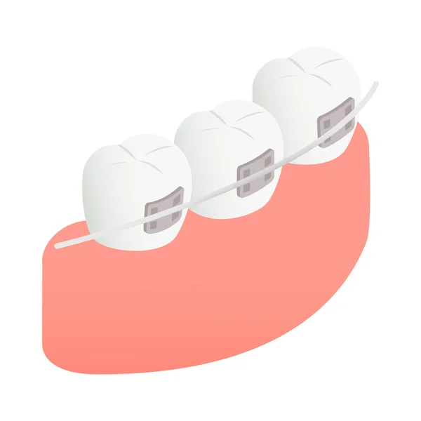 Aparaty na zęby ikona, izometryczny styl 3d — Wektor stockowy