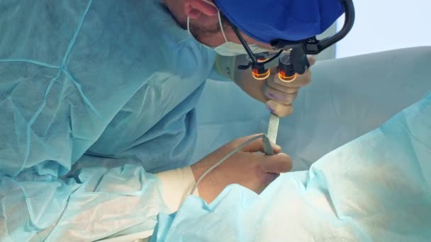 Il chirurgo esegue un'operazione chirurgica — Video Stock