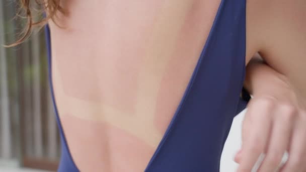 Una chica en traje de baño azul y con manicura roja toca su espalda, enrojecida por el sol. Una mujer se toca la espalda, en la que había un rastro de una quemadura de sol en forma de traje de baño contra la pared. — Vídeos de Stock