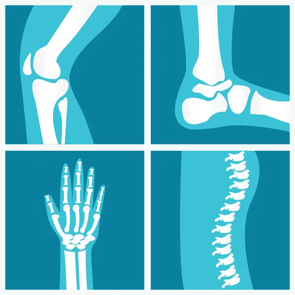 Set of human joints. — Stock Illustration Set of human joints. Vector Graphics