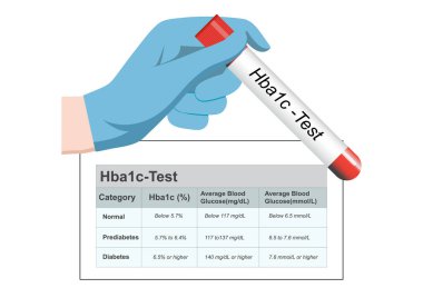 HbA1c is a blood test that measures average blood sugar levels over the past twenty three months to monitor diabetes control.Medical health care, vector illustration.