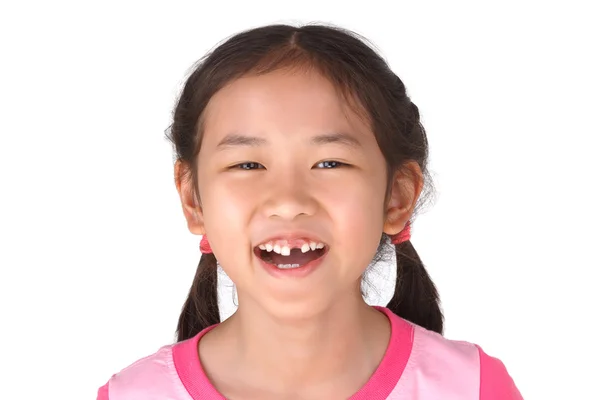 Pequena menina bonito sorriso com seu dente quebrado. fundo branco . — Fotografia de Stock