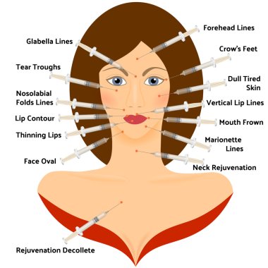 Hyaluronic Asid Infographic. Face Plastic Surgery