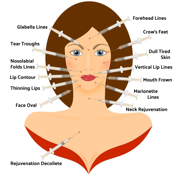 Hialuronowy Asid infografikę. Chirurgia plastyczna twarzy — Wektor stockowy