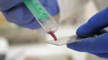 Elleri ilaç eldivenlerinde, cam bir tabağa kan sıçratıyordu. Ellerinde ilaç eldivenleri vardı. Şırıngayı tutuyorlardı, kan basıyorlardı ve cam bir tabağa yayıyorlardı.