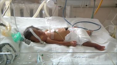 Küçük Maternity Hospital hastada
