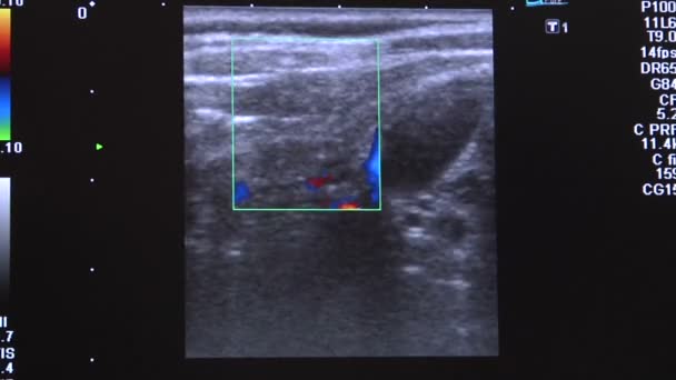 Doktor hasta Ultrasonografi yapıyor — Stok video