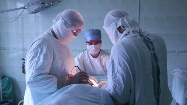 Operación quirúrgica en el hospital — Vídeo de stock