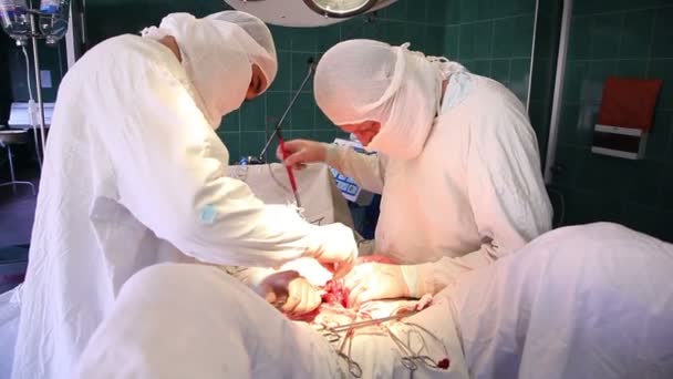 Equipe médica realizando operação — Vídeo de Stock