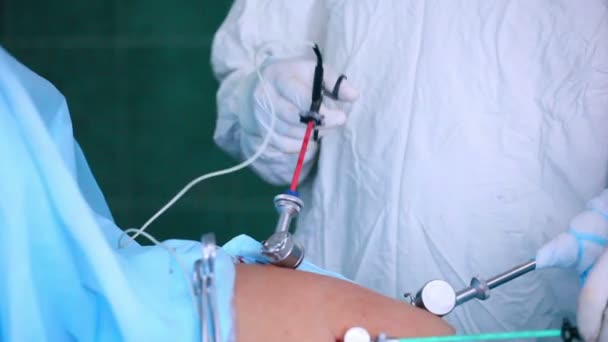 Laparoskopik cerrahi karın — Stok video