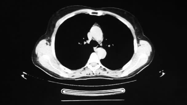 Multispektrale Tomographie des Kopfes — Stockvideo