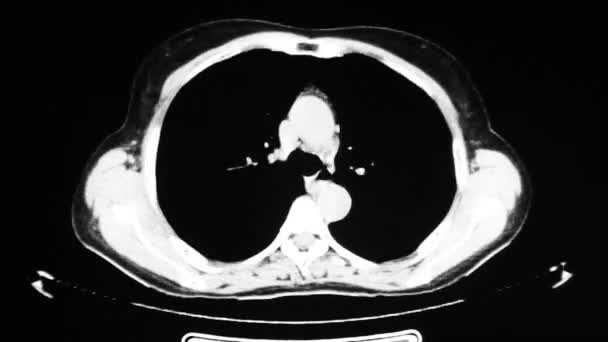 Iç organlar bilgisayarlı tomografi — Stok video