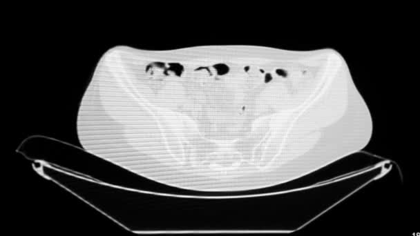 Datortomografi av inre organ — Stockvideo