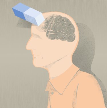 Hasta alzheimer illüstrasyon ve hafıza kaybı