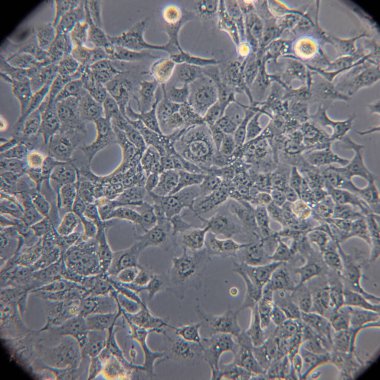 Bakteriler ve virüsler gri arka planda. Bilim ve tıp kavramı. Yüksek kalite fotoğraf