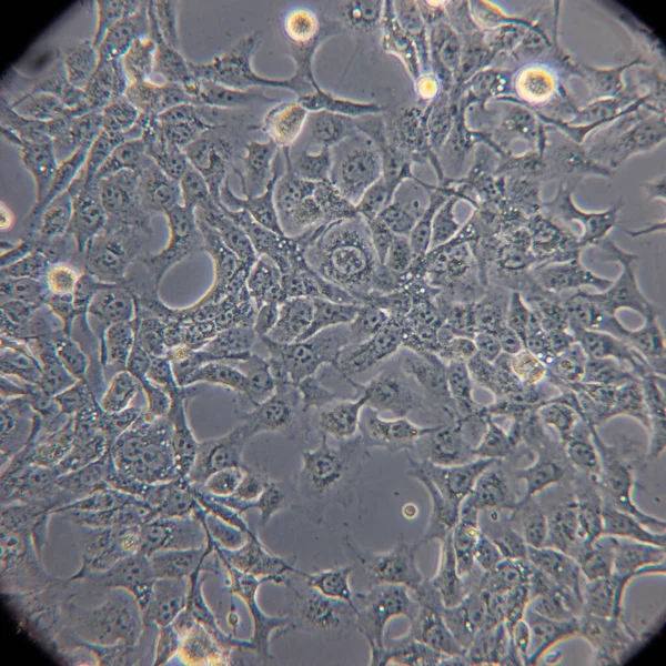 Bakteriler ve virüsler gri arka planda. Bilim ve tıp kavramı. Yüksek kalite fotoğraf