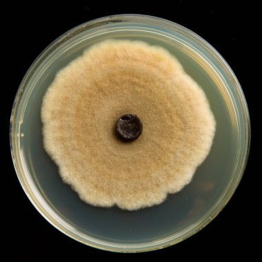 Laboratuvarda mikroorganizmalar ve bakterilerle dolu bir bakteri kabı var.