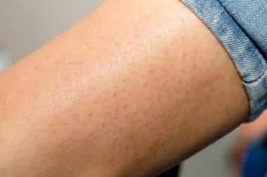 İnsan derisinin yakın plan görüntüsü