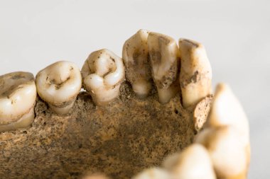 Beyaz arkaplanda eski dişlere sahip çene